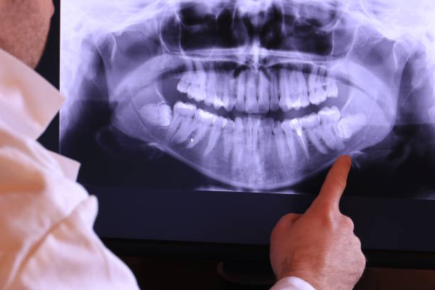 Best Emergency Dental Surgery in Hughes Springs, TX