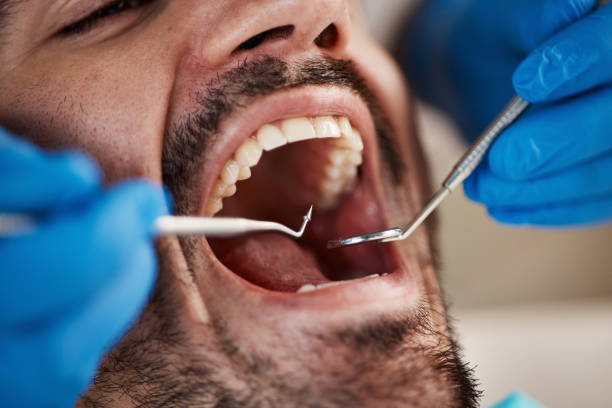 Best Emergency Tooth Extraction in Hughes Springs, TX