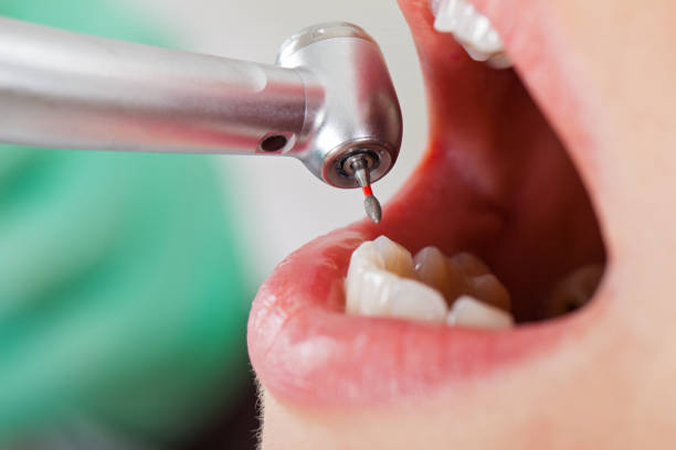 Best After-Hours Emergency Dentist in Hughes Springs, TX